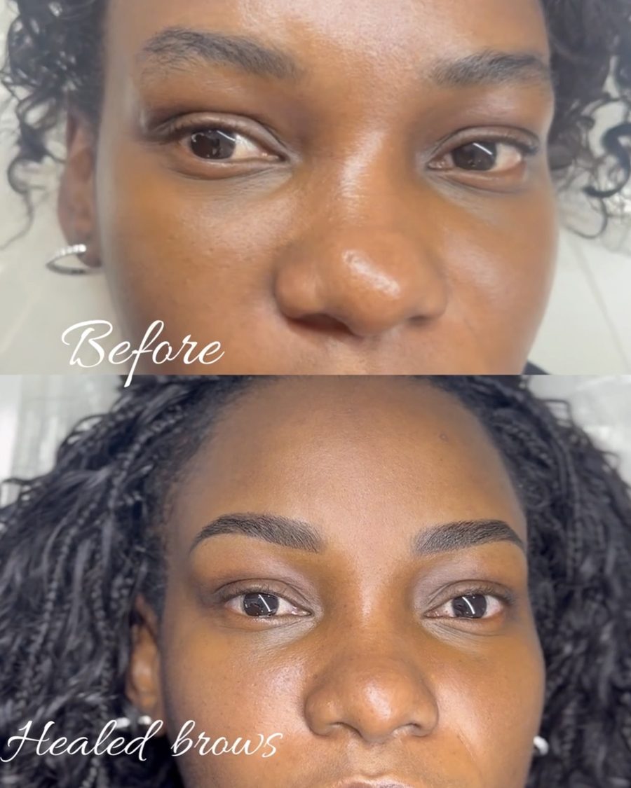 Before and healed brows on a client with braided hair, Beauty by Yiyus, Newark NJ